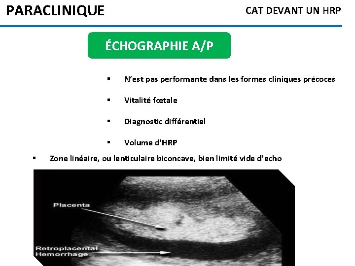 PARACLINIQUE CAT DEVANT UN HRP ÉCHOGRAPHIE A/P § § N’est pas performante dans les