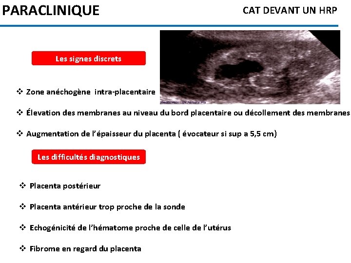 PARACLINIQUE CAT DEVANT UN HRP Les signes discrets v Zone anéchogène intra-placentaire v Élevation