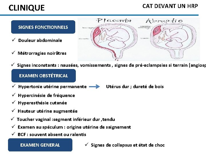 CLINIQUE CAT DEVANT UN HRP SIGNES FONCTIONNELS ü Douleur abdominale ü Métrorragies noirâtres ü