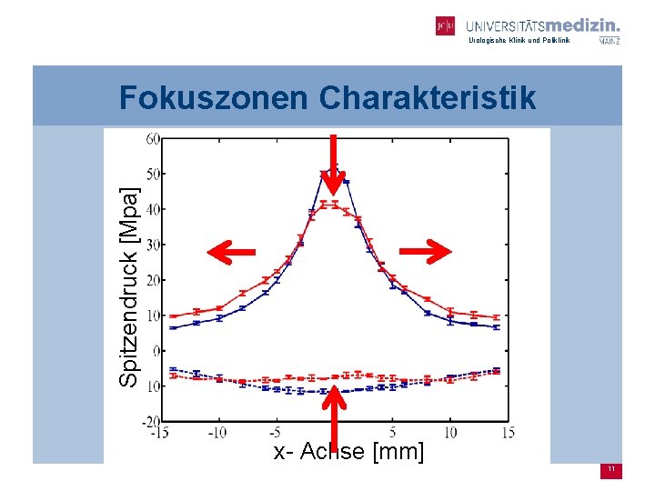 Urologische Klinik und Poliklinik Spitzendruck [Mpa] Fokuszonen Charakteristik x- Achse [mm] 11 