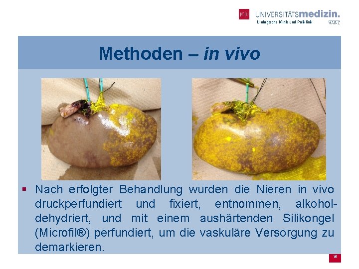 Urologische Klinik und Poliklinik Methoden – in vivo § Nach erfolgter Behandlung wurden die