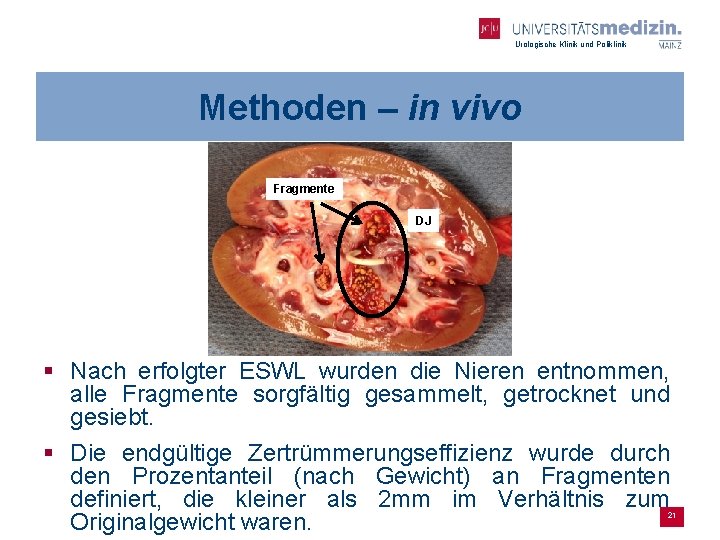 Urologische Klinik und Poliklinik Methoden – in vivo Fragmente DJ § Nach erfolgter ESWL