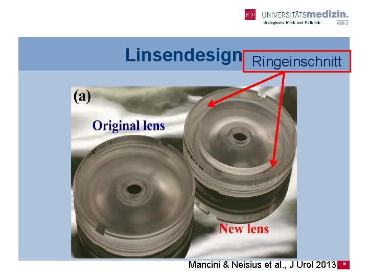 Urologische Klinik und Poliklinik Linsendesign Ringeinschnitt Mancini & Neisius et al. , J Urol