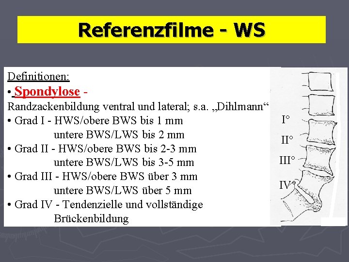 Referenzfilme - WS Definitionen: • Spondylose Randzackenbildung ventral und lateral; s. a. „Dihlmann“ I°
