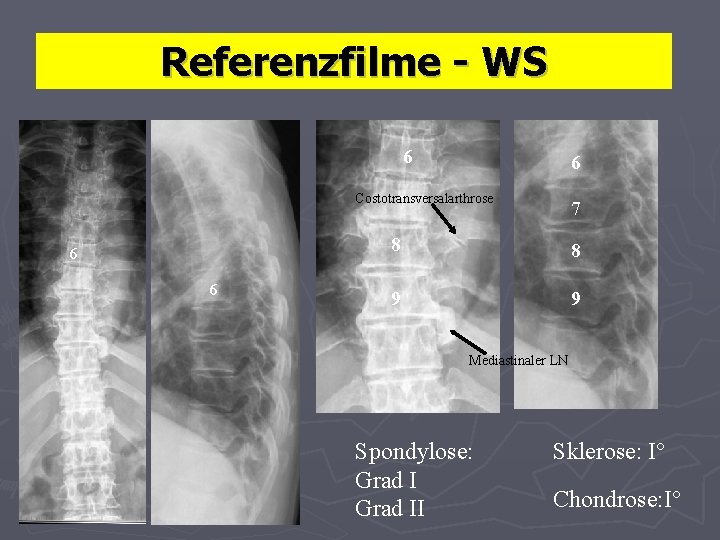 Referenzfilme - WS 6 6 Costotransversalarthrose 7 6 6 7 8 8 9 9