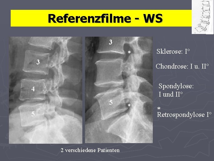 Referenzfilme - WS 3 * 3 Sklerose: I° Chondrose: I u. II° Spondylose: I