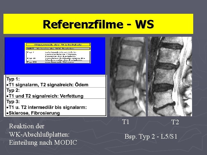 Referenzfilme - WS Reaktion der WK-Abschlußplatten: Einteilung nach MODIC T 1 T 2 Bsp.