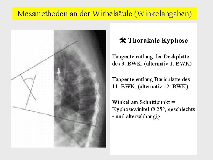 Messmethoden an der Wirbelsäule (Winkelangaben) Thorakale Kyphose Tangente entlang der Deckplatte des 3. BWK,