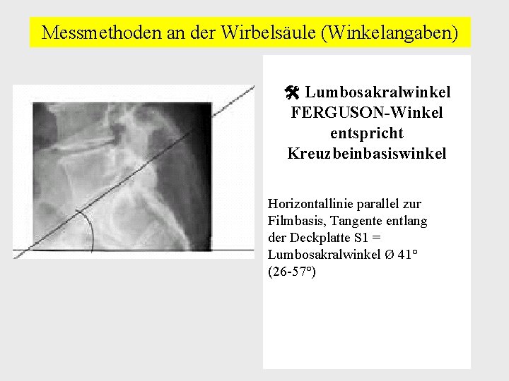 Messmethoden an der Wirbelsäule (Winkelangaben) Lumbosakralwinkel FERGUSON-Winkel entspricht Kreuzbeinbasiswinkel Horizontallinie parallel zur Filmbasis, Tangente