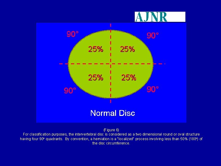 (Figure 6) For classification purposes, the intervertebral disc is considered as a two dimensional