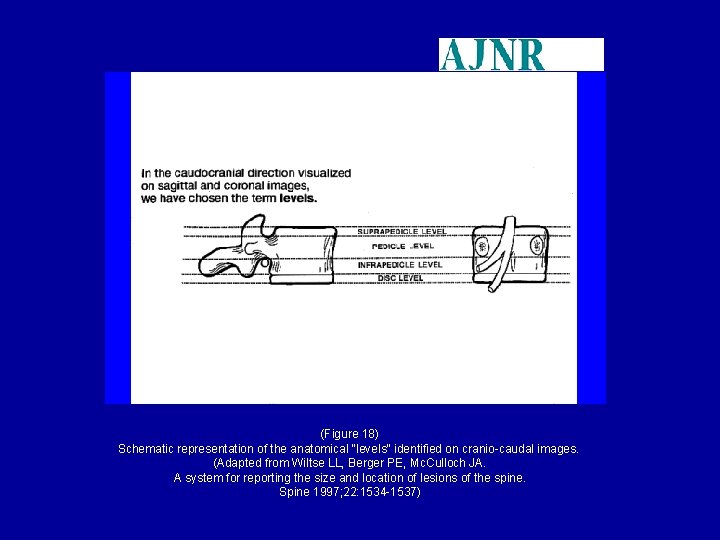 (Figure 18) Schematic representation of the anatomical "levels" identified on cranio-caudal images. (Adapted from