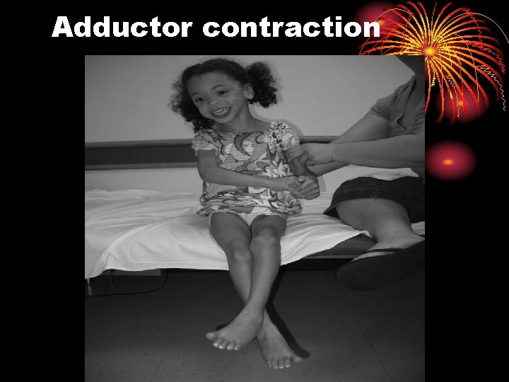 Adductor contraction 