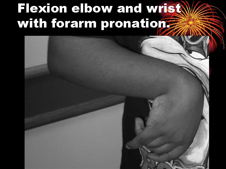 Flexion elbow and wrist with forarm pronation. 