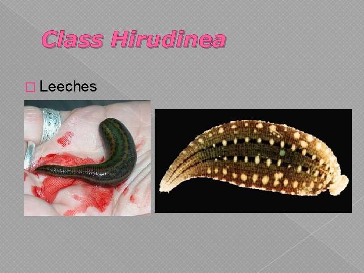 Class Hirudinea � Leeches 