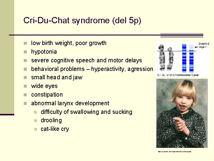 Cri-Du-Chat syndrome (del 5 p) n low birth weight, poor growth n hypotonia n