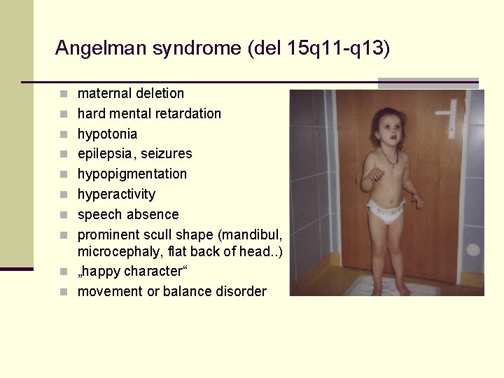 Angelman syndrome (del 15 q 11 -q 13) n maternal deletion n hard mental