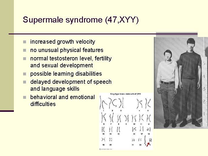 Supermale syndrome (47, XYY) n increased growth velocity n no unusual physical features n