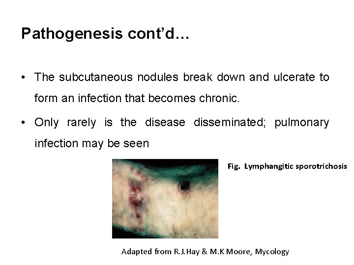 Pathogenesis cont’d… • The subcutaneous nodules break down and ulcerate to form an infection