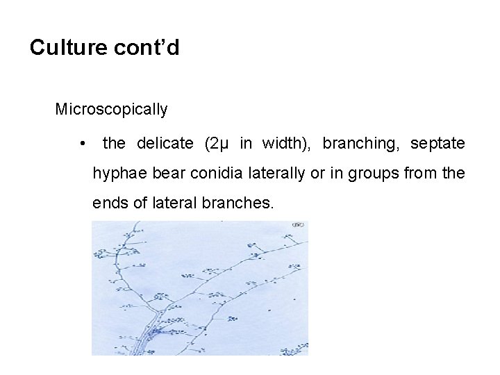 Culture cont’d Microscopically • the delicate (2µ in width), branching, septate hyphae bear conidia