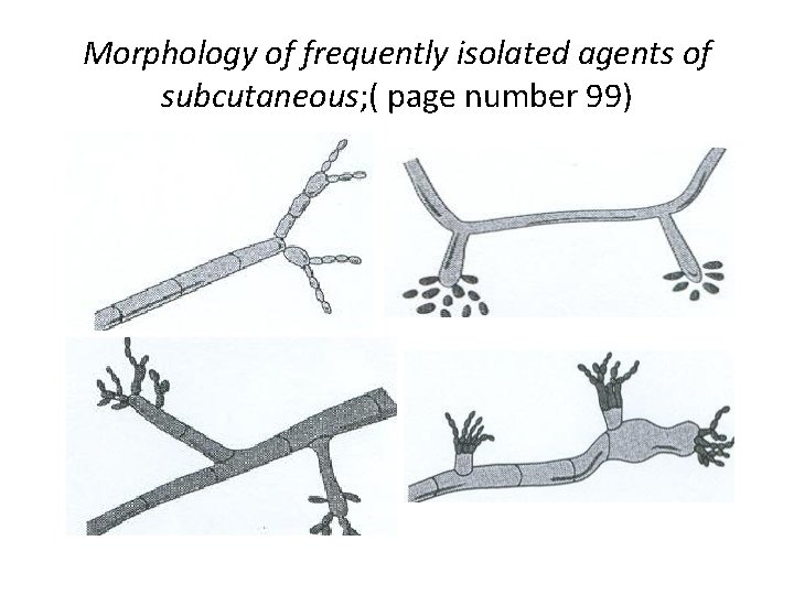 Morphology of frequently isolated agents of subcutaneous; ( page number 99) 