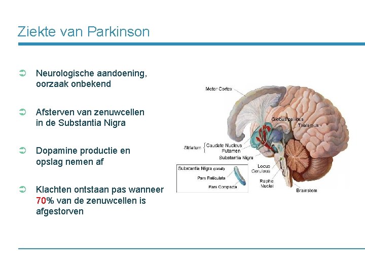 Ziekte van Parkinson Ü Neurologische aandoening, oorzaak onbekend Ü Afsterven van zenuwcellen in de