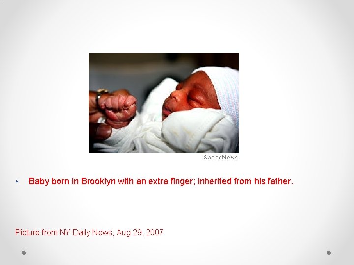  • Baby born in Brooklyn with an extra finger; inherited from his father.