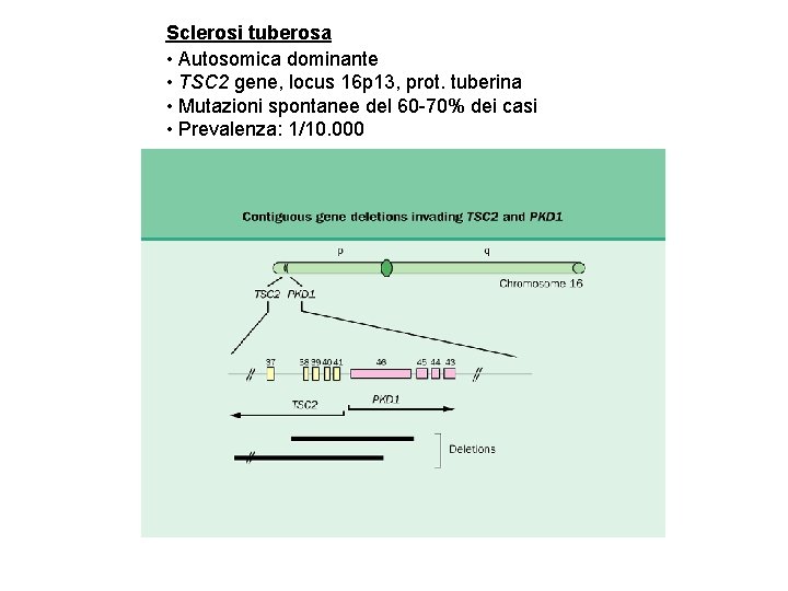 Sclerosi tuberosa • Autosomica dominante • TSC 2 gene, locus 16 p 13, prot.