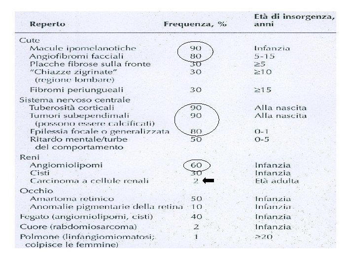 Caratteristiche cliniche della TSC 