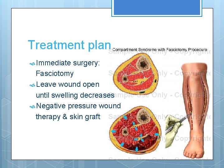 Treatment plan Immediate surgery: Fasciotomy Leave wound open until swelling decreases Negative pressure wound