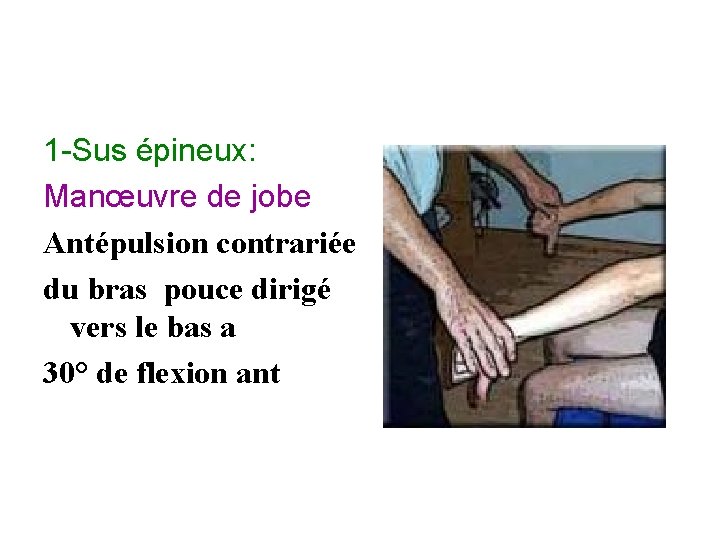 1 -Sus épineux: Manœuvre de jobe Antépulsion contrariée du bras pouce dirigé vers le