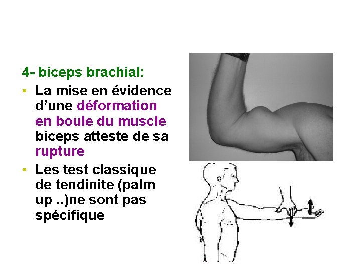 4 - biceps brachial: • La mise en évidence d’une déformation en boule du