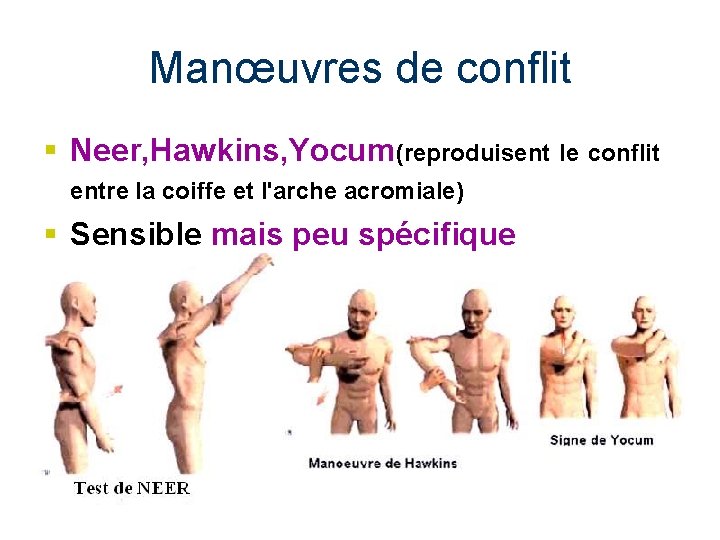 Manœuvres de conflit § Neer, Hawkins, Yocum(reproduisent le conflit entre la coiffe et l'arche