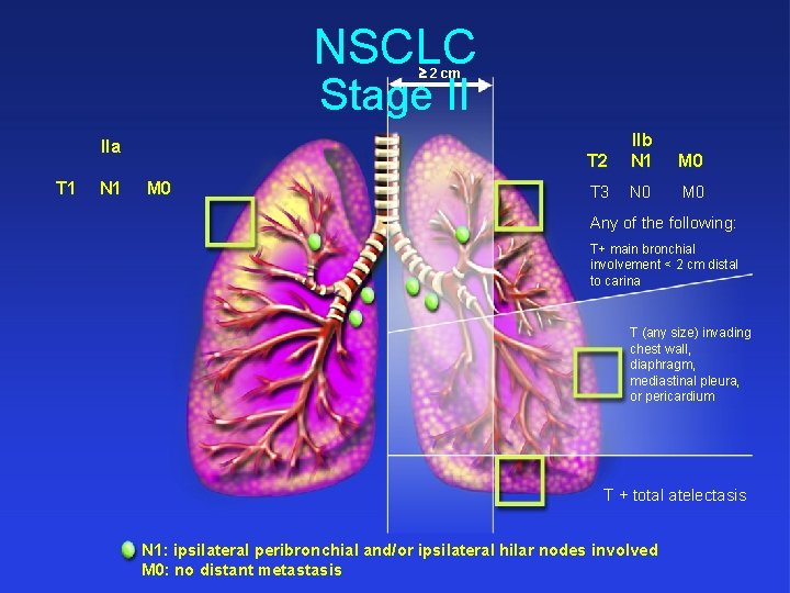 NSCLC 2 cm Stage II IIa T 1 N 1 M 0 T 2