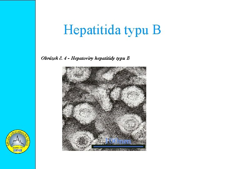 Hepatitida typu B Obrázek č. 4 - Hepatoviry hepatitidy typu B 