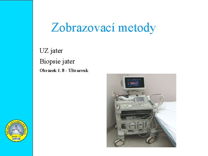 Zobrazovací metody UZ jater Biopsie jater Obrázek č. 8 - Ultrazvuk 