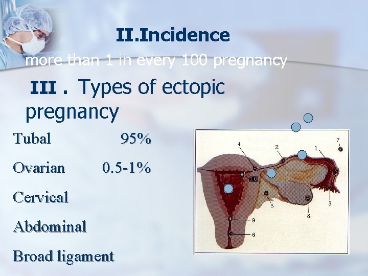 II. Incidence more than 1 in every 100 pregnancy III. Types of ectopic pregnancy