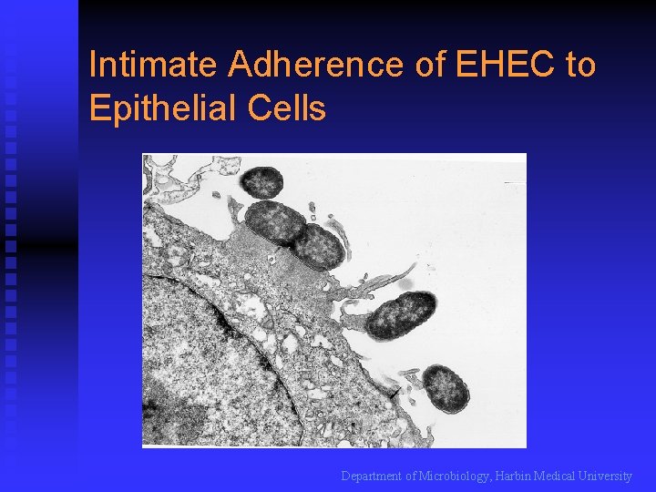 Intimate Adherence of EHEC to Epithelial Cells Department of Microbiology, Harbin Medical University 