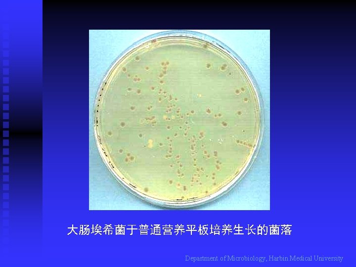 大肠埃希菌于普通营养平板培养生长的菌落 Department of Microbiology, Harbin Medical University 