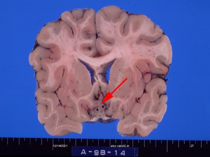 12/14/2021 alen vukelić, dr 27 