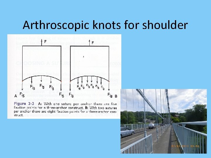 Arthroscopic knots for shoulder 