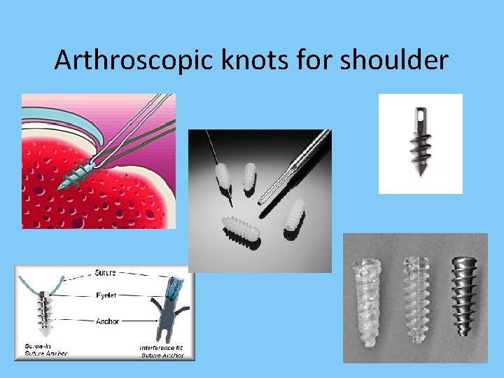 Arthroscopic knots for shoulder 