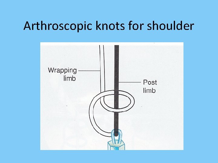 Arthroscopic knots for shoulder 