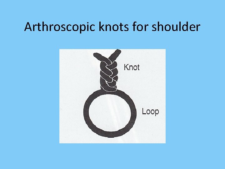 Arthroscopic knots for shoulder 