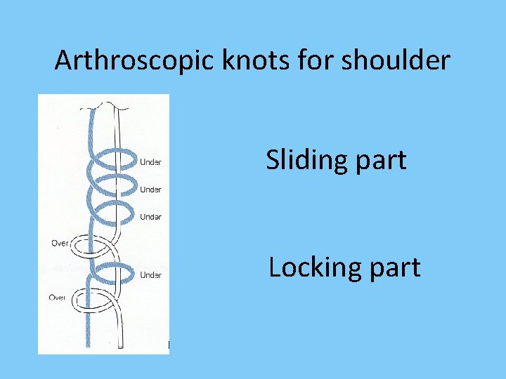 Arthroscopic knots for shoulder Sliding part Locking part 