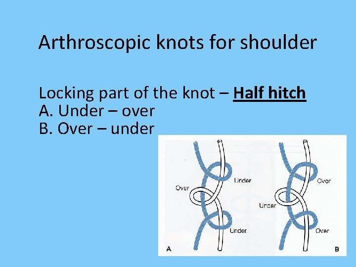 Arthroscopic knots for shoulder Locking part of the knot – Half hitch A. Under