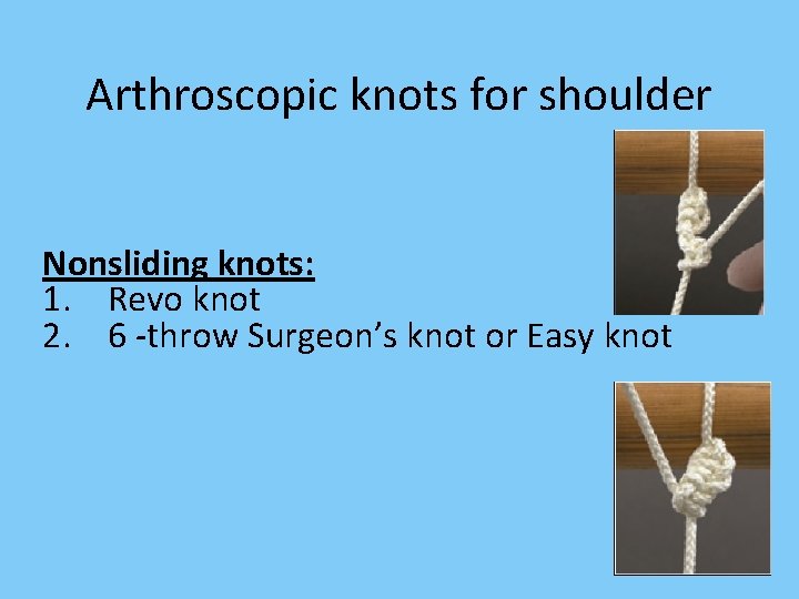 Arthroscopic knots for shoulder Nonsliding knots: 1. Revo knot 2. 6 -throw Surgeon’s knot