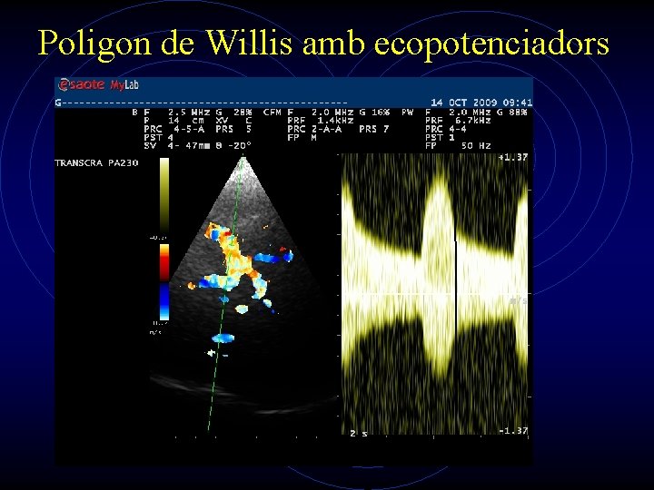 Poligon de Willis amb ecopotenciadors 