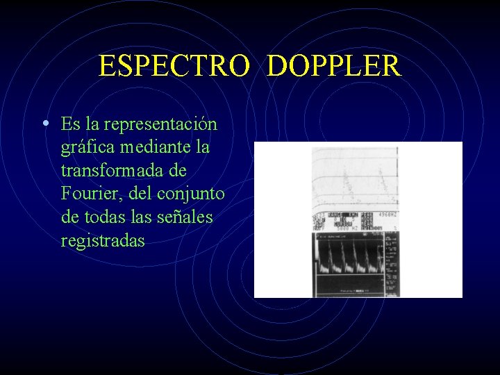 ESPECTRO DOPPLER • Es la representación gráfica mediante la transformada de Fourier, del conjunto