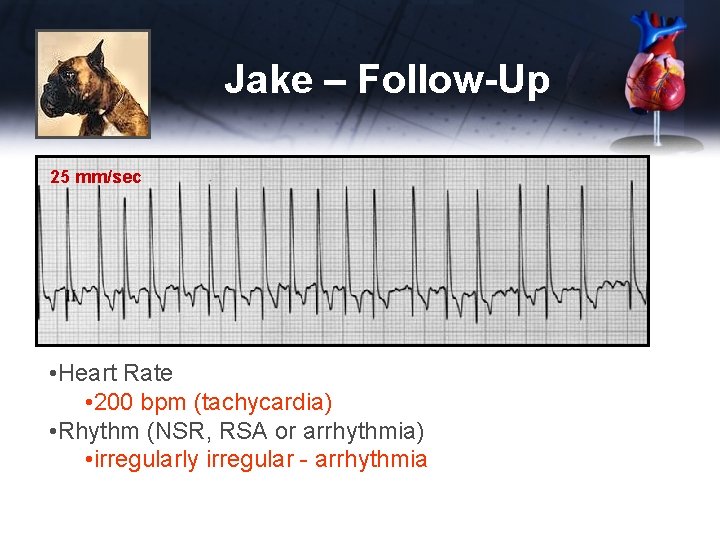 Jake – Follow-Up 25 mm/sec • Heart Rate • 200 bpm (tachycardia) • Rhythm