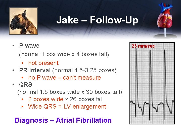 Jake – Follow-Up • P wave (normal 1 box wide x 4 boxes tall)